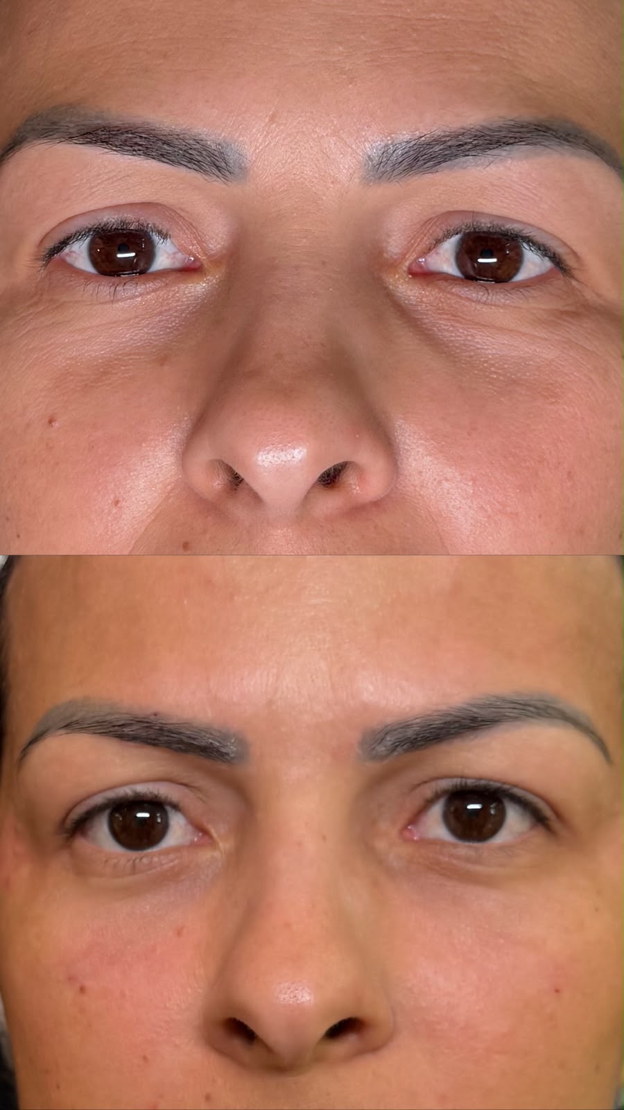 Caso clínico de harmonização facial